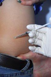 The future of male birth control